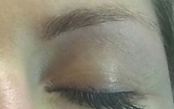 article-trichotillomanie-academie-du-regard