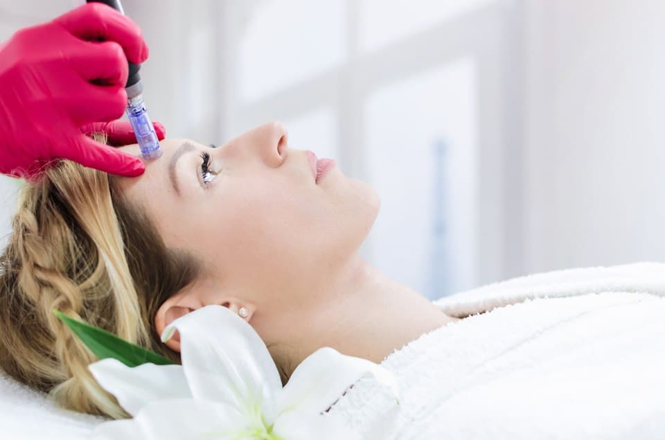 Qu’est-ce que le microneedling ?
